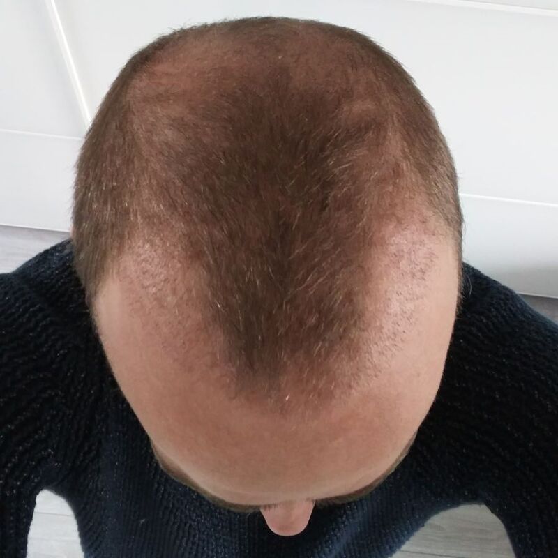 Esteworld voelt als thuiskomen