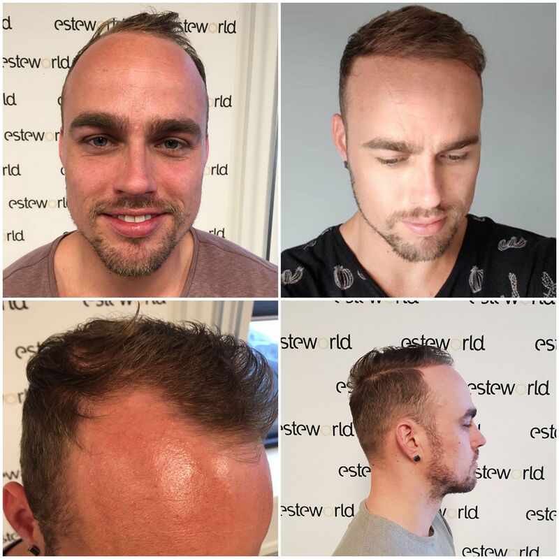 Esteworld voelt als thuiskomen