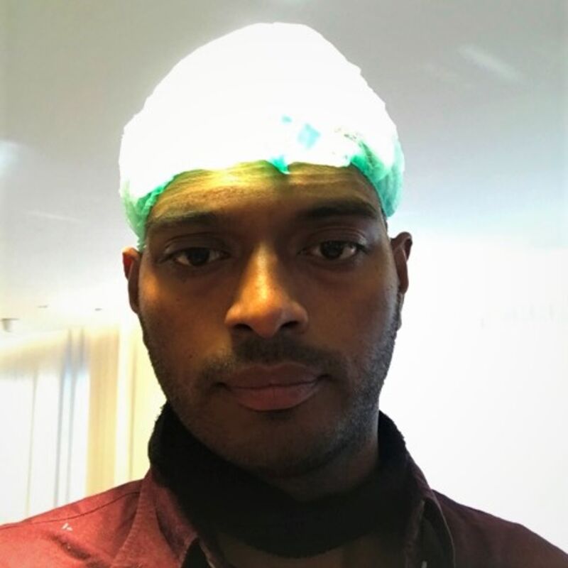 Kasan, 1/3de van kosten haartransplantatie in Nederland