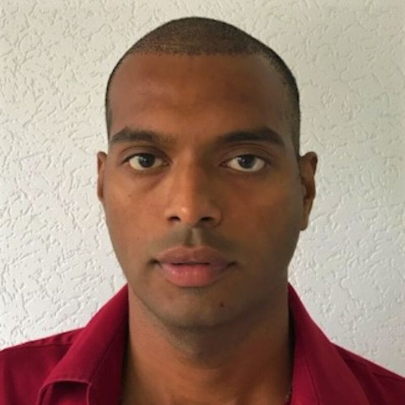 Kasan, 1/3de van kosten haartransplantatie in Nederland