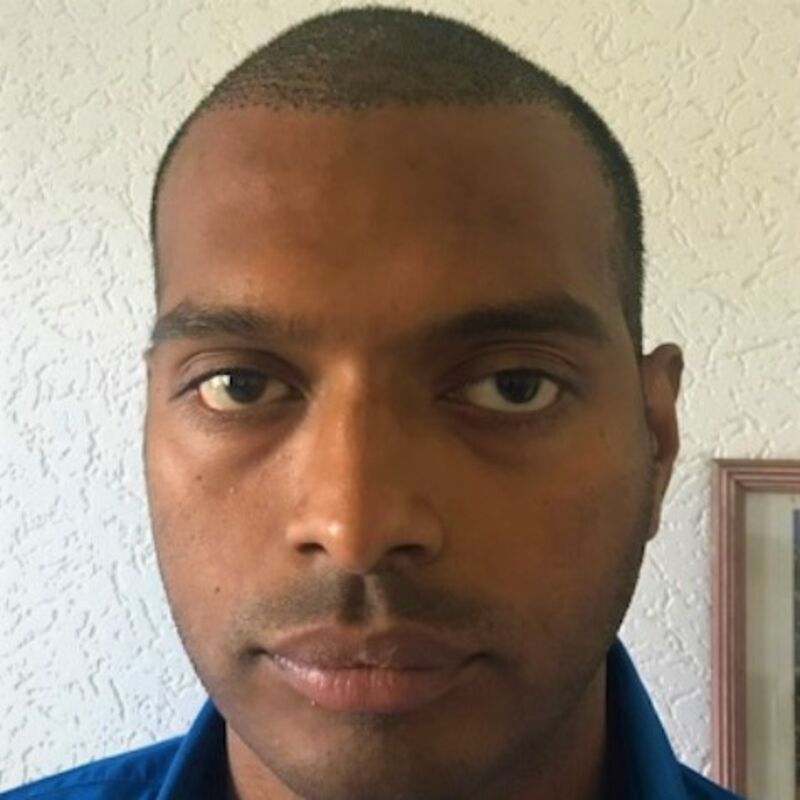 Kasan, 1/3de van kosten haartransplantatie in Nederland