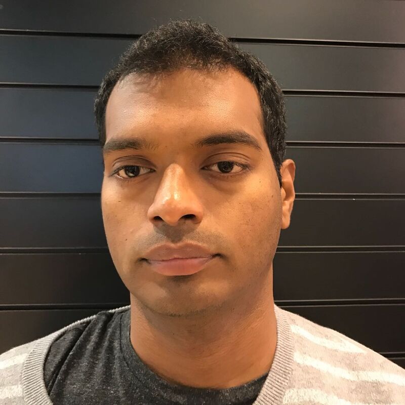 Kasan, 1/3de van kosten haartransplantatie in Nederland