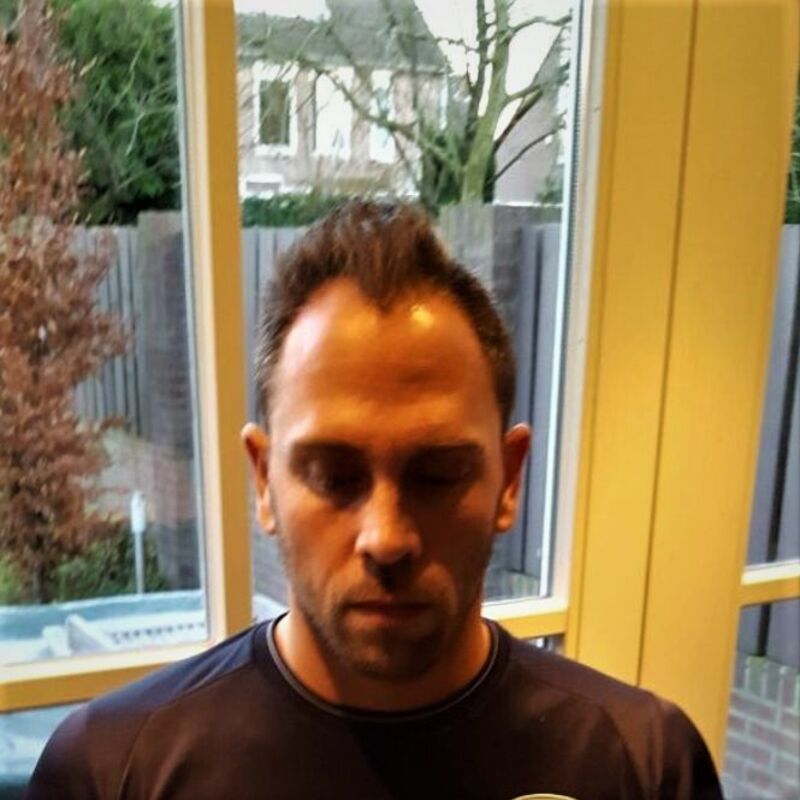 Eric, De hele haartransplantatie is perfect verlopen!