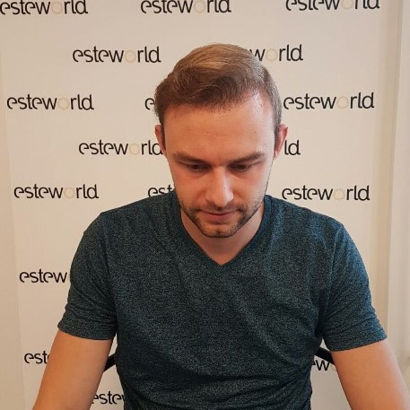 Manuel blij met zijn haartransplantatie resultaat!