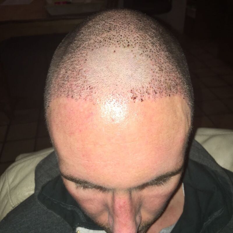 Yordi, Esteworld is een echte aanrader!