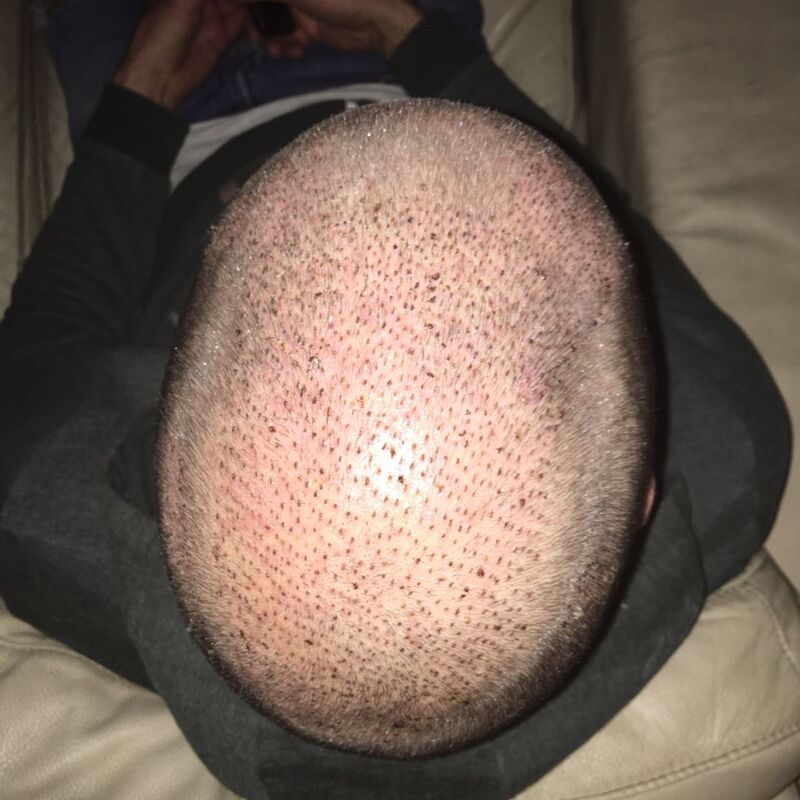 Yordi, Esteworld is een echte aanrader!