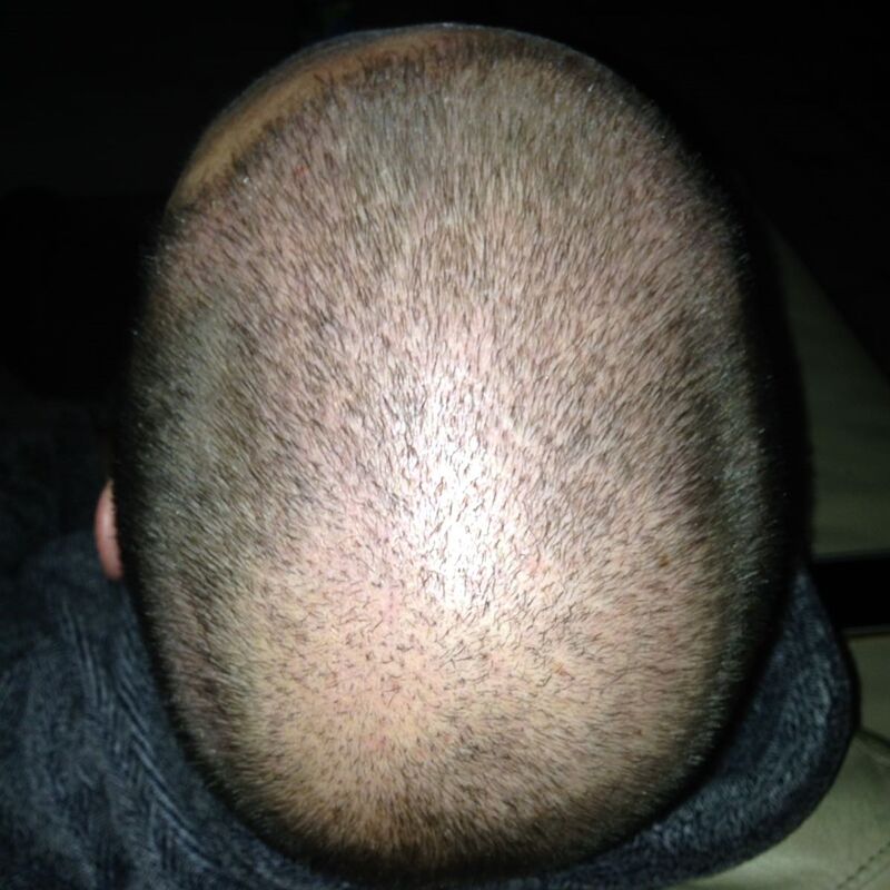 Yordi, Esteworld is een echte aanrader!