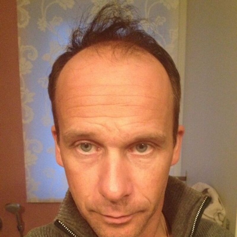 Positief gevoel over gehouden aan de haar implantatie!