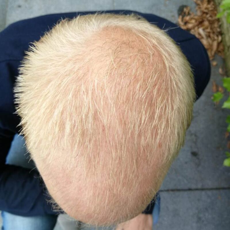 Vooraf getwijfeld maar ik zeg DOEN met wat ik nu weet!