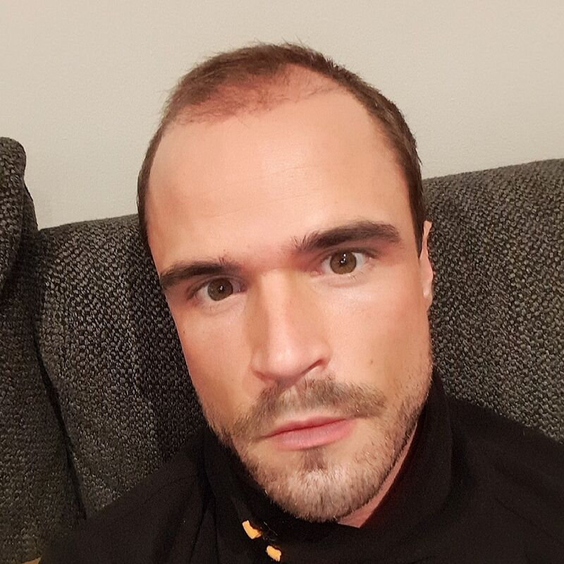 Wat doe je als je haar langzaam verdwijnt? Esteworld! 