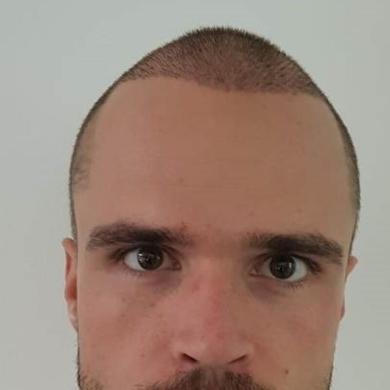 Wat doe je als je haar langzaam verdwijnt? Esteworld! 