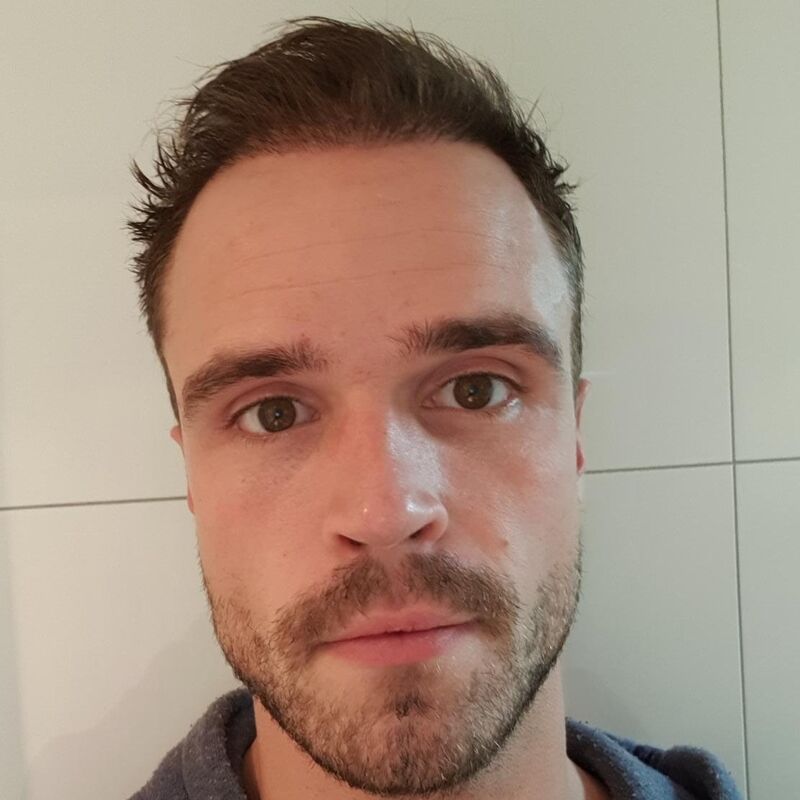 Wat doe je als je haar langzaam verdwijnt? Esteworld! 