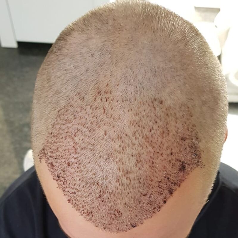 Wat doe je als je haar langzaam verdwijnt? Esteworld! 