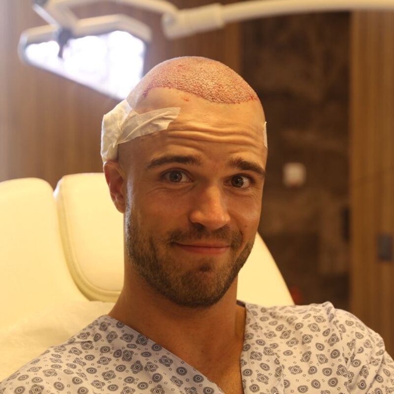 Wat doe je als je haar langzaam verdwijnt? Esteworld! 