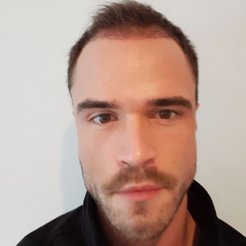 Wat doe je als je haar langzaam verdwijnt? Esteworld! 