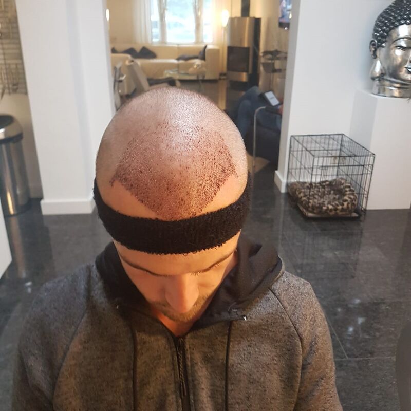Wat doe je als je haar langzaam verdwijnt? Esteworld! 