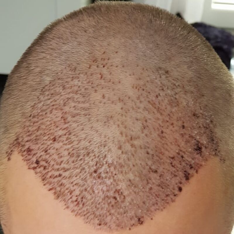 Wat doe je als je haar langzaam verdwijnt? Esteworld! 