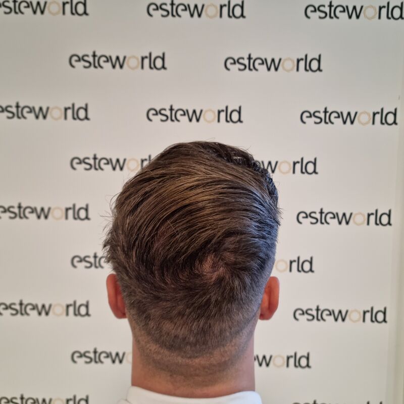 Wat doe je als je haar langzaam verdwijnt? Esteworld! 