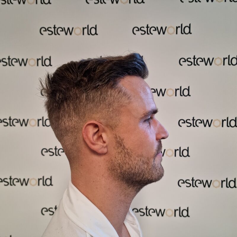 Wat doe je als je haar langzaam verdwijnt? Esteworld! 