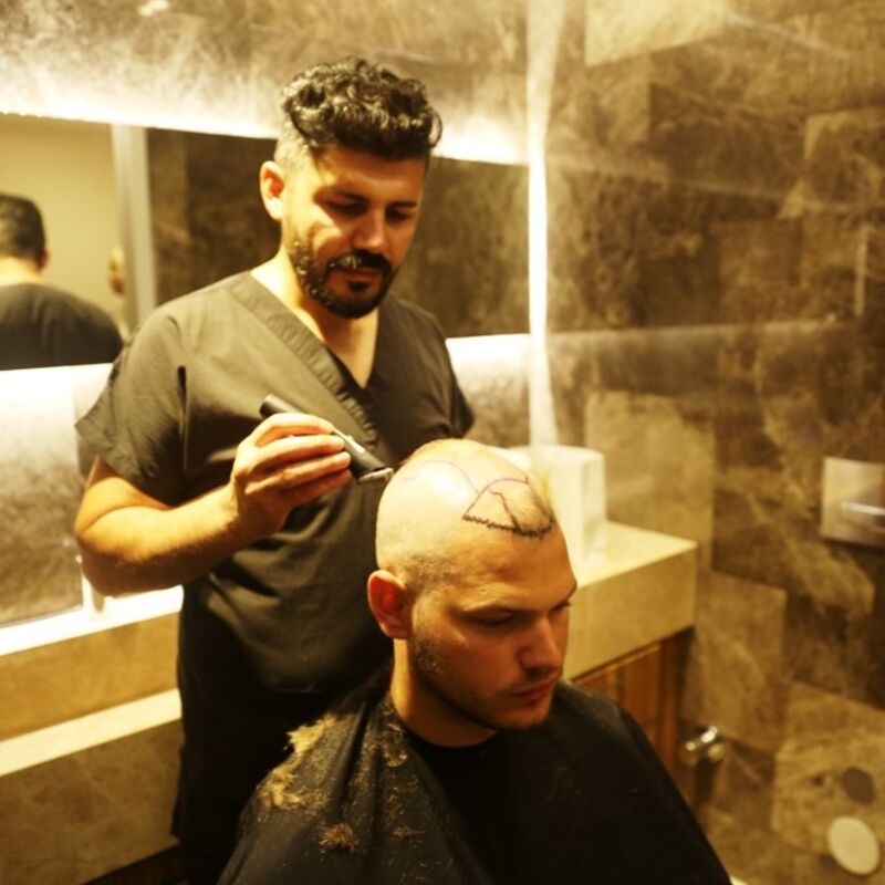 Haartransplantatie Coupe in Istanbul!