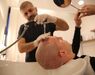 Altunizade haartransplantatie kliniek