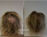 Low Level Laser Therapie (LLLT)