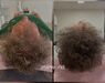 Low Level Laser Therapie (LLLT)