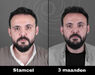 Acell stamcel behandeling