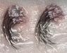 Haartransplantaties zonder scheren en de Long Hair methode