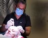 Haartransplantaties zonder scheren en de Long Hair methode
