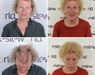 Haartransplantaties zonder scheren en de Long Hair methode