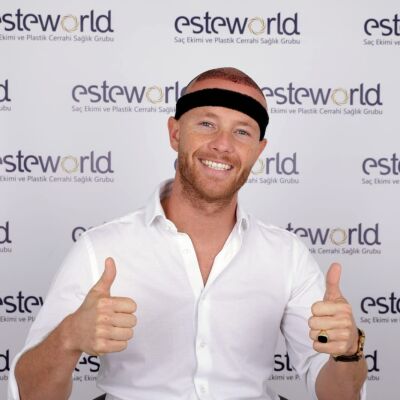 Review over haartransplantatie?