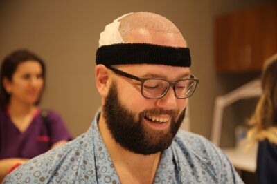 Haartransplantatie in Istanbul