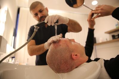 Hoe verloopt het herstel na een haartransplantatie?