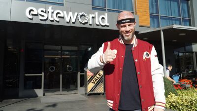 Wat is de beste leeftijd voor een haartransplantatie?