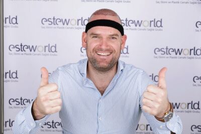 Vanuit België een haartransplantaie in Turkije