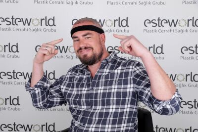 Haarimplantatie ervaringen