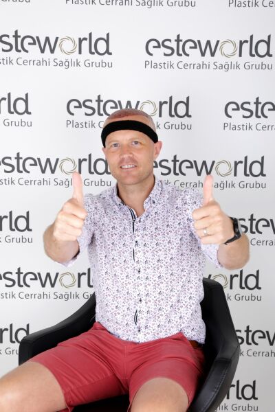 PRP behandeling ervaringen