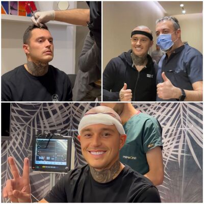 Haartransplantatie opleiding