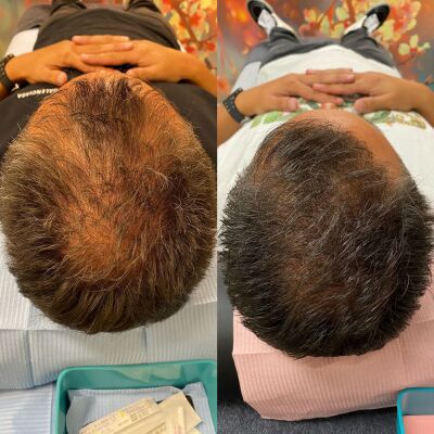 XL Hair is een innovatieve behandeling