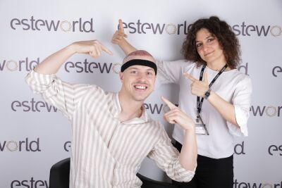 Haartransplantatie Consult in Nederland