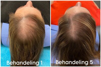 Esteworld Huidkliniek in Utrecht