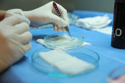 Haartransplantatie en Veelgestelde Vragen: Een Diepgaande Gids