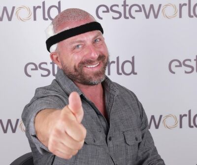 Beste haargroeimiddelen