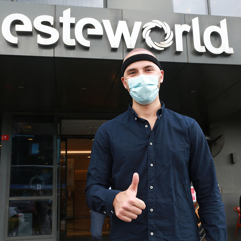 Jelmer, 100% vertrouwen in haartransplantatie resultaat