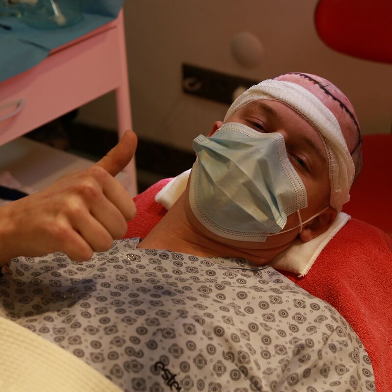 Haartransplantatie bij Esteworld? Aanrader!